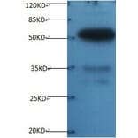 Osteopontin Monoclonal Antibody from Signalway Antibody (42036) - Antibodies.com