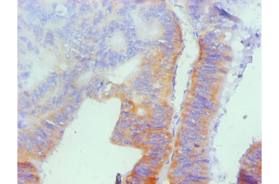 Immunohistochemistry - Osteopontin Monoclonal Antibody from Signalway Antibody (42036) - Antibodies.com