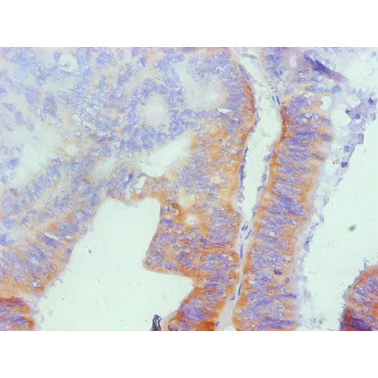 Immunohistochemistry - Osteopontin Monoclonal Antibody from Signalway Antibody (42036) - Antibodies.com