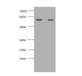 Kininogen-1 Polyclonal Antibody from Signalway Antibody (42586) - Antibodies.com