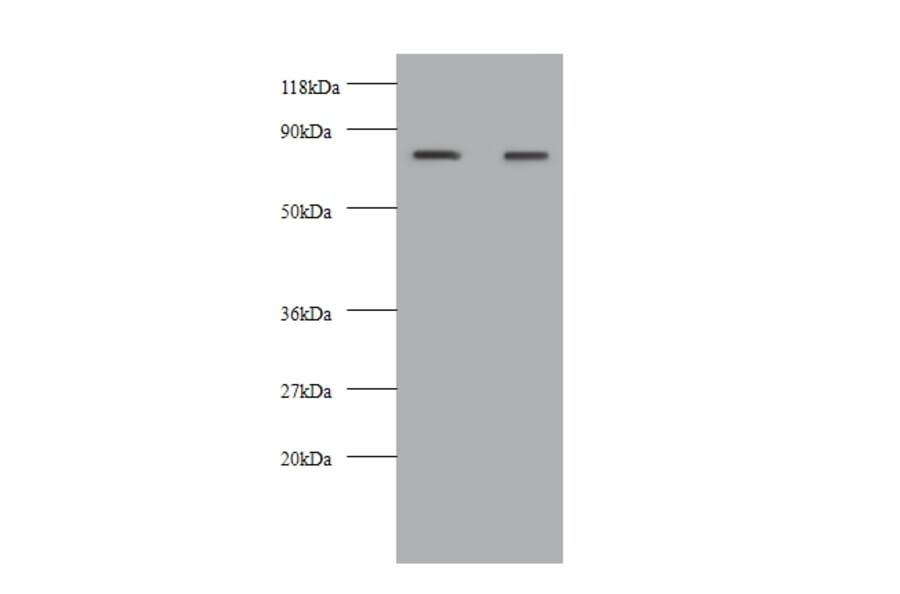 Kininogen-1 Polyclonal Antibody from Signalway Antibody (42586) - Antibodies.com