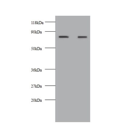 Kininogen-1 Polyclonal Antibody from Signalway Antibody (42586) - Antibodies.com