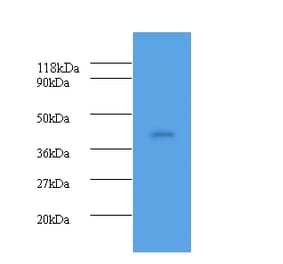 Haptoglobin Polyclonal Antibody from Signalway Antibody (42609) - Antibodies.com
