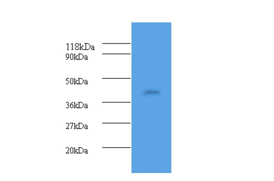 Haptoglobin Polyclonal Antibody from Signalway Antibody (42609) - Antibodies.com
