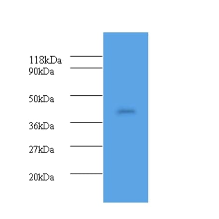 Haptoglobin Polyclonal Antibody from Signalway Antibody (42609) - Antibodies.com