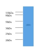 Haptoglobin Polyclonal Antibody from Signalway Antibody (42609) - Antibodies.com