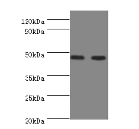 Sialidase-3 Polyclonal Antibody from Signalway Antibody (42611) - Antibodies.com