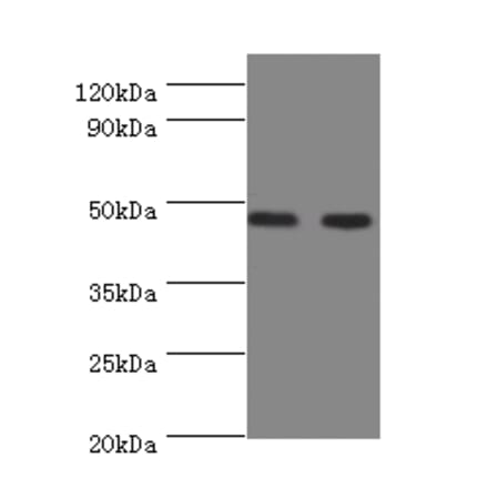 Sialidase-3 Polyclonal Antibody from Signalway Antibody (42611) - Antibodies.com