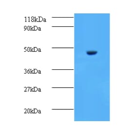 Aspartate aminotransferase, cytoplasmic Polyclonal Antibody from Signalway Antibody (42188) - Antibodies.com