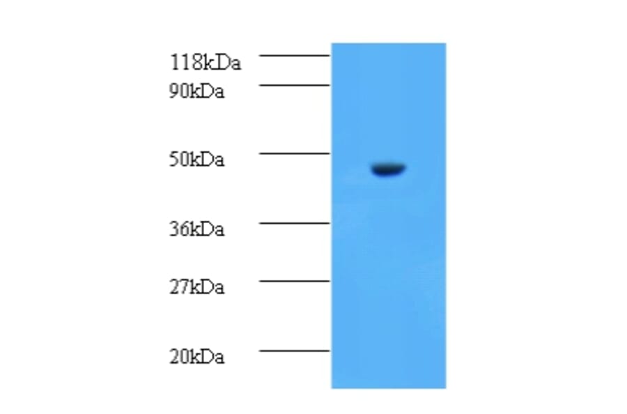 Aspartate aminotransferase, cytoplasmic Polyclonal Antibody from Signalway Antibody (42188) - Antibodies.com