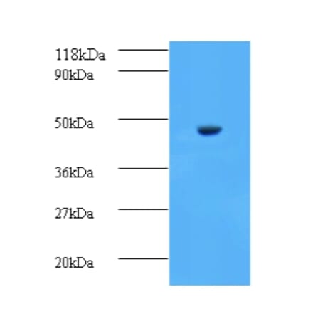 Aspartate aminotransferase, cytoplasmic Polyclonal Antibody from Signalway Antibody (42188) - Antibodies.com