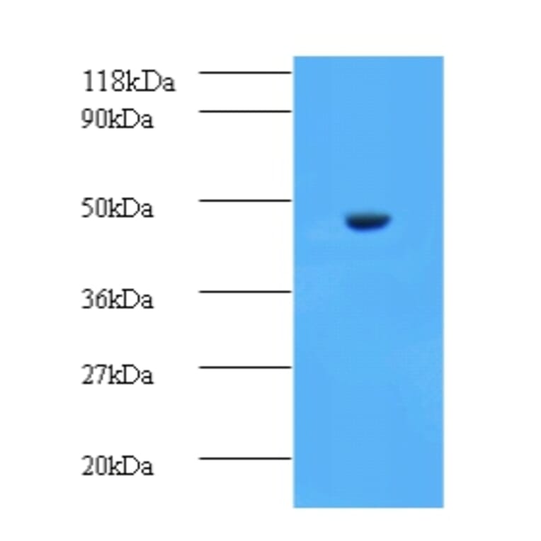 Aspartate aminotransferase, cytoplasmic Polyclonal Antibody from Signalway Antibody (42188) - Antibodies.com