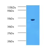 Aspartate aminotransferase, cytoplasmic Polyclonal Antibody from Signalway Antibody (42188) - Antibodies.com