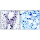 Immunohistochemistry - PTEN (Ab-380/382/383) Antibody from Signalway Antibody (21056) - Antibodies.com