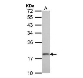 ribosomal protein S10 antibody from Signalway Antibody (22116) - Antibodies.com