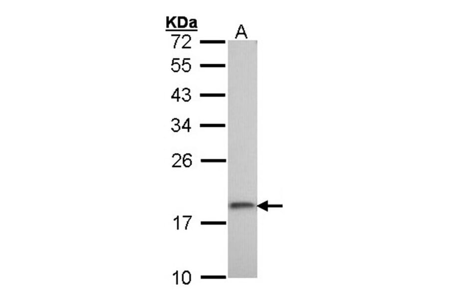 ribosomal protein S10 antibody from Signalway Antibody (22116) - Antibodies.com