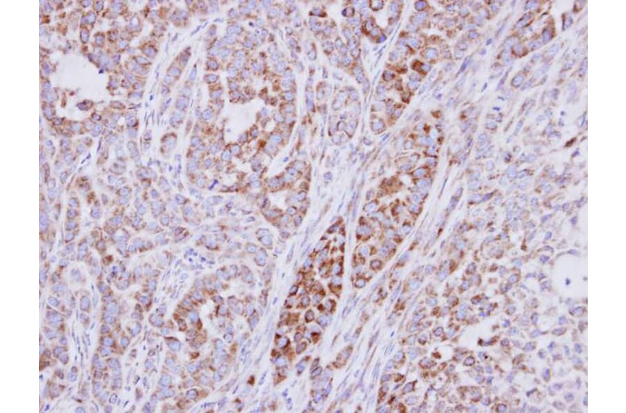 Immunohistochemistry - ribosomal protein S10 antibody from Signalway Antibody (22116) - Antibodies.com