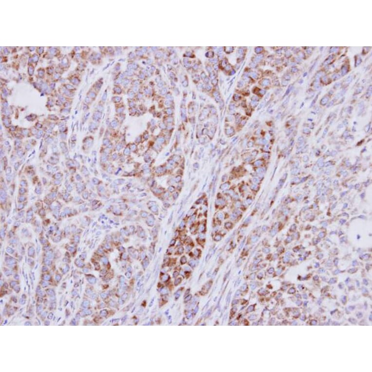 Immunohistochemistry - ribosomal protein S10 antibody from Signalway Antibody (22116) - Antibodies.com