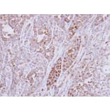 Immunohistochemistry - ribosomal protein S10 antibody from Signalway Antibody (22116) - Antibodies.com