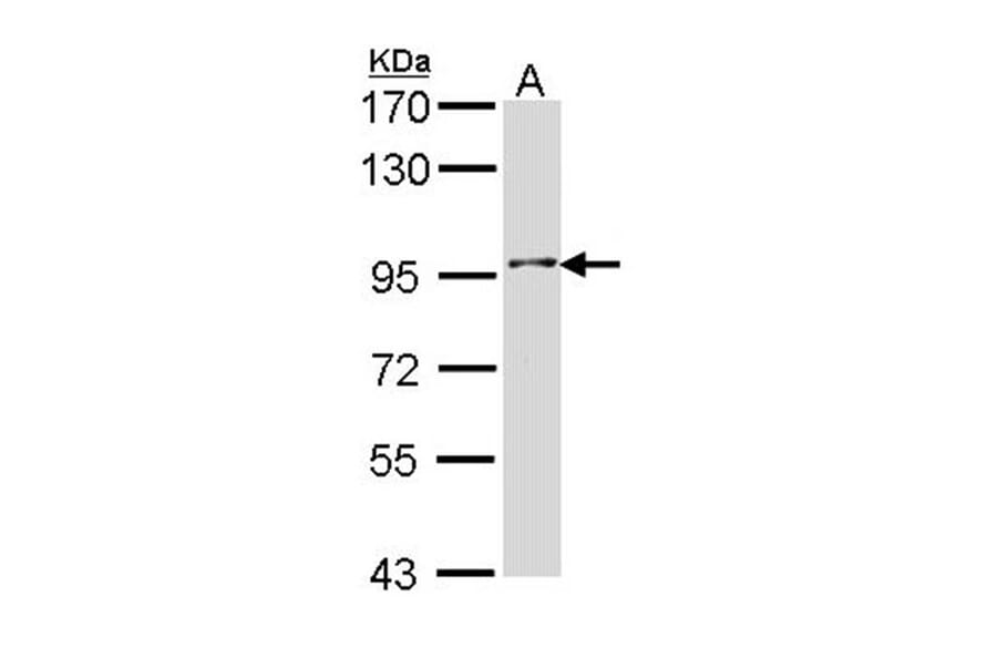 Type II 5-phosphatase antibody from Signalway Antibody (22141) - Antibodies.com