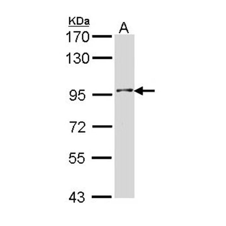Type II 5-phosphatase antibody from Signalway Antibody (22141) - Antibodies.com