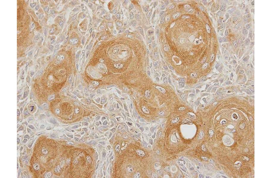 Immunohistochemistry - Type II 5-phosphatase antibody from Signalway Antibody (22141) - Antibodies.com