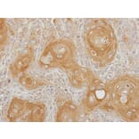 Immunohistochemistry - Type II 5-phosphatase antibody from Signalway Antibody (22141) - Antibodies.com