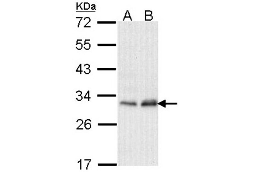 Phosphomannomutase 2 antibody from Signalway Antibody (22237) - Antibodies.com