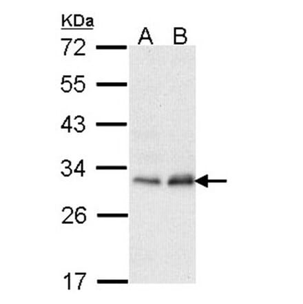 Phosphomannomutase 2 antibody from Signalway Antibody (22237) - Antibodies.com