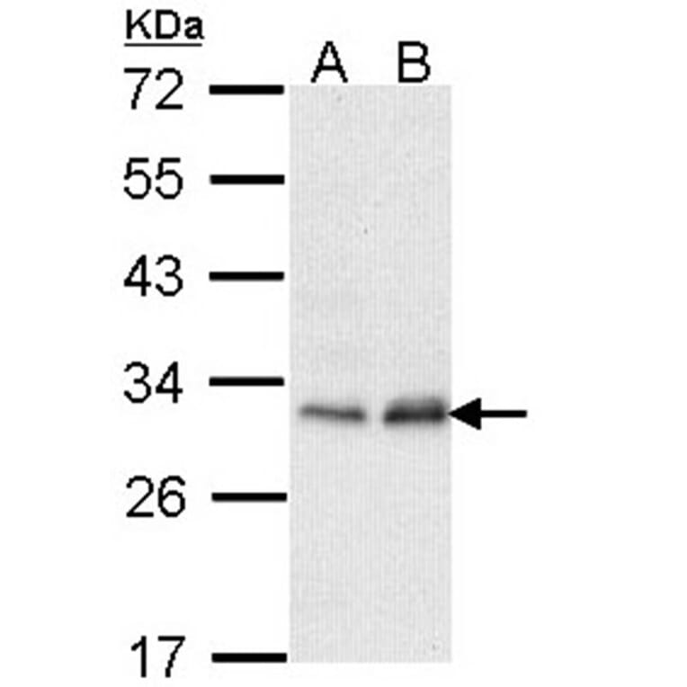 Phosphomannomutase 2 antibody from Signalway Antibody (22237) - Antibodies.com