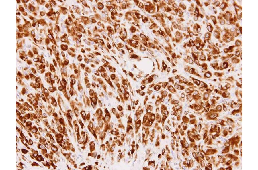 Immunohistochemistry - Phosphomannomutase 2 antibody from Signalway Antibody (22237) - Antibodies.com