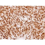 Immunohistochemistry - Phosphomannomutase 2 antibody from Signalway Antibody (22237) - Antibodies.com