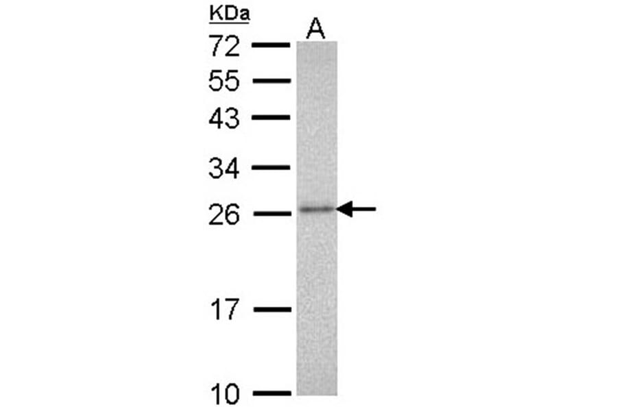 20S Proteasome alpha3 antibody from Signalway Antibody (22598) - Antibodies.com