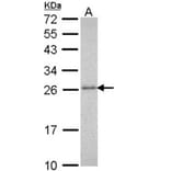 20S Proteasome alpha3 antibody from Signalway Antibody (22598) - Antibodies.com