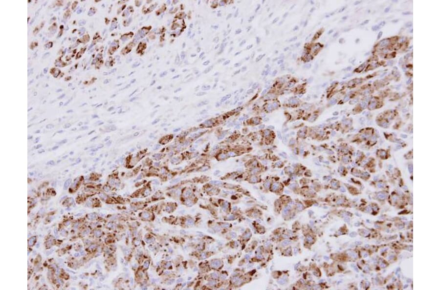 Immunohistochemistry - 20S Proteasome alpha3 antibody from Signalway Antibody (22598) - Antibodies.com