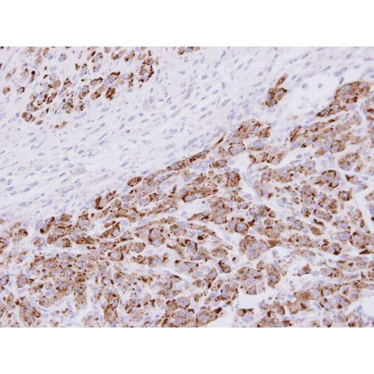 Immunohistochemistry - 20S Proteasome alpha3 antibody from Signalway Antibody (22598) - Antibodies.com