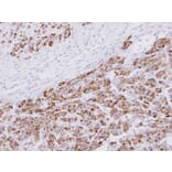 Immunohistochemistry - 20S Proteasome alpha3 antibody from Signalway Antibody (22598) - Antibodies.com