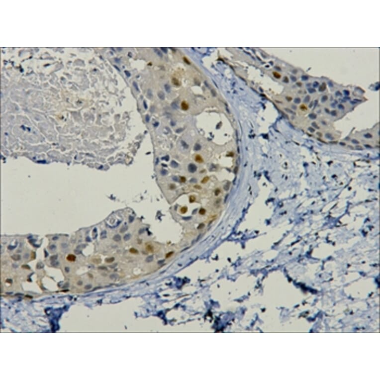 PCNA Mouse Monoclonal Antibody from Signalway Antibody (37978) - Antibodies.com