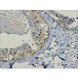 PCNA Mouse Monoclonal Antibody from Signalway Antibody (37978) - Antibodies.com