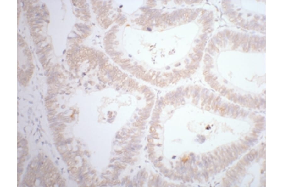 CDX2 Mouse Monoclonal Antibody from Signalway Antibody (38012) - Antibodies.com