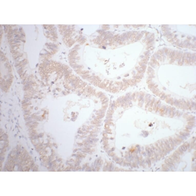 CDX2 Mouse Monoclonal Antibody from Signalway Antibody (38012) - Antibodies.com