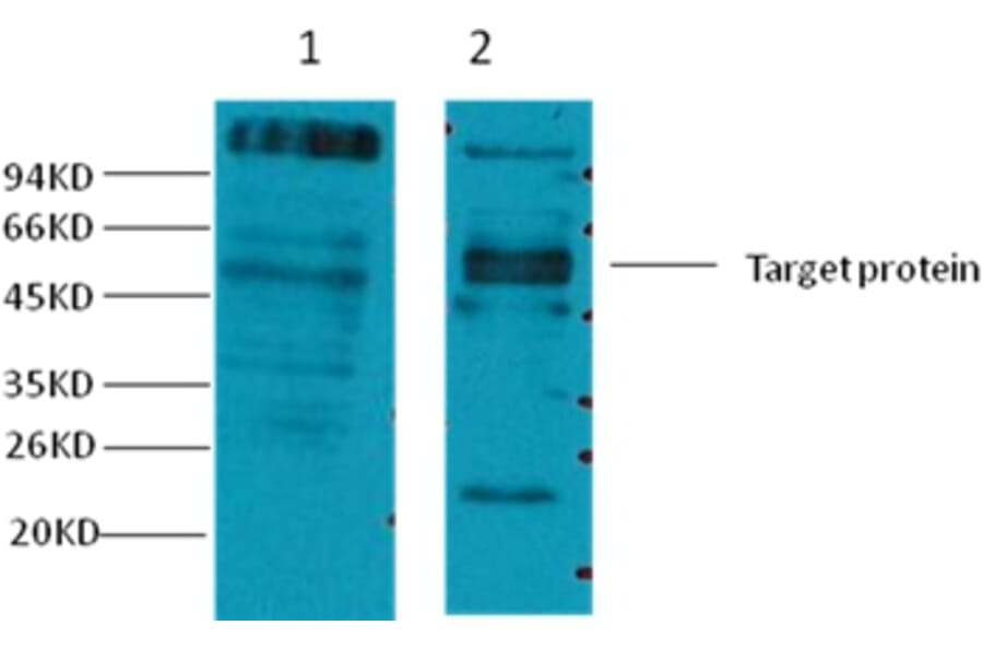 Western blot - CD23 Mouse Monoclonal Antibody from Signalway Antibody (38039) - Antibodies.com