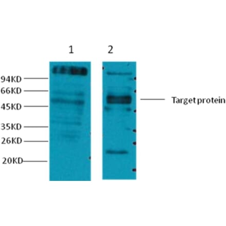 Western blot - CD23 Mouse Monoclonal Antibody from Signalway Antibody (38039) - Antibodies.com