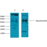 Western blot - CD23 Mouse Monoclonal Antibody from Signalway Antibody (38039) - Antibodies.com