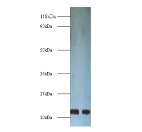 Transgelin Polyclonal Antibody from Signalway Antibody (42165) - Antibodies.com