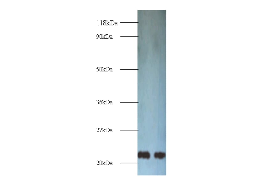 Transgelin Polyclonal Antibody from Signalway Antibody (42165) - Antibodies.com
