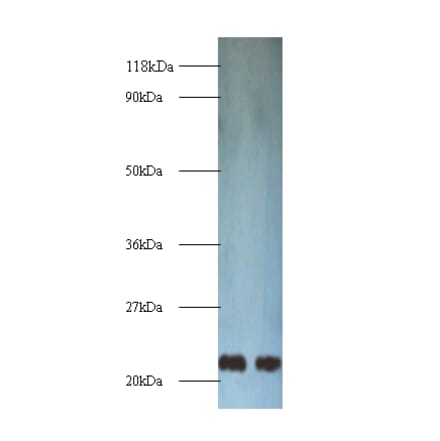 Transgelin Polyclonal Antibody from Signalway Antibody (42165) - Antibodies.com