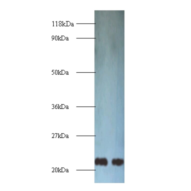 Transgelin Polyclonal Antibody from Signalway Antibody (42165) - Antibodies.com