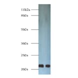 Transgelin Polyclonal Antibody from Signalway Antibody (42165) - Antibodies.com