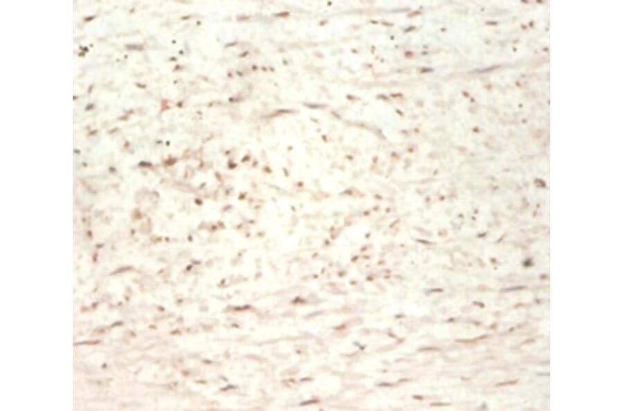 Immunohistochemistry - Transgelin Polyclonal Antibody from Signalway Antibody (42165) - Antibodies.com